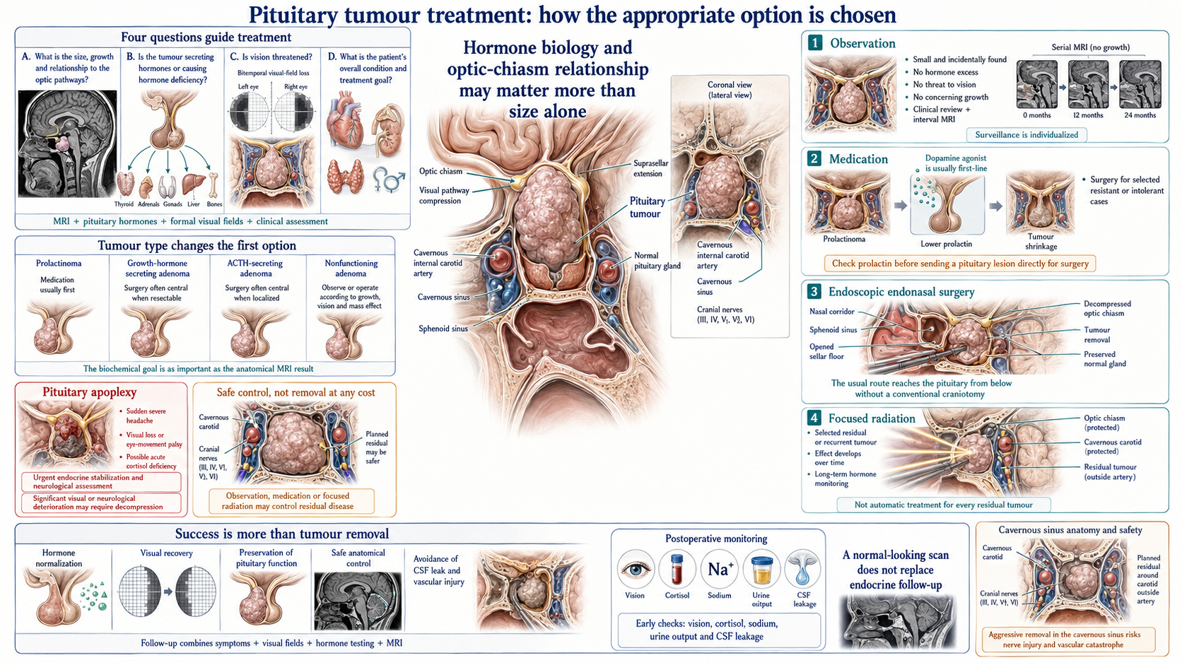 Pituitary Tumour Treatment: How the Appropriate Option Is Chosen