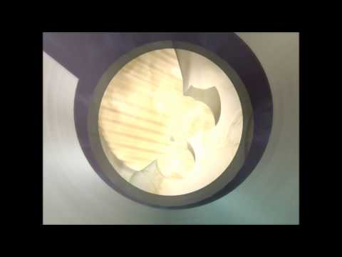 Minimally Invasive Spinal Decompression - Dr Manish Vaish