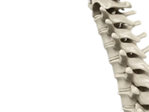 The Best Treatment for Brain Aneurysm - Sushrut Brain and Spine