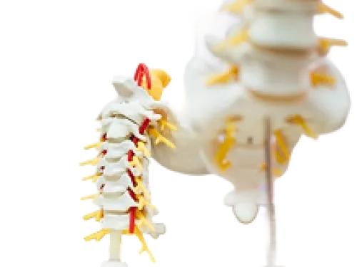 Get The Right Treatment For Spinal Cord Tumors