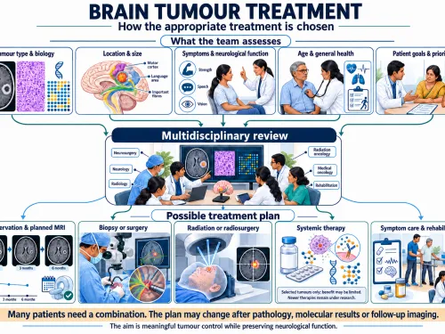 Brain Tumour Treatment: How the Appropriate Treatment Is Chosen