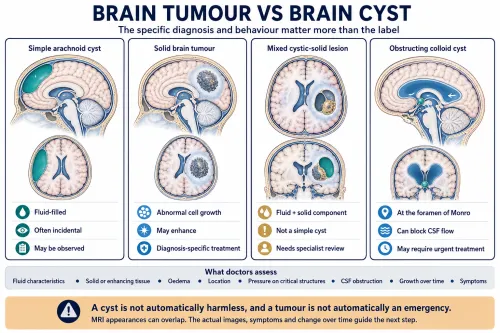 Brain Tumour vs Brain Cyst