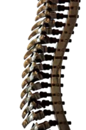 What are some neurological disorders that affect movement and coordination?